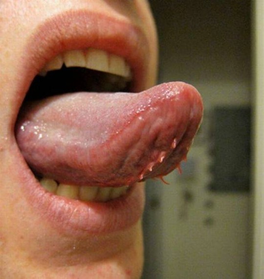 weird tongue